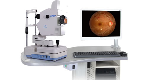 FS-C1 fundus camera